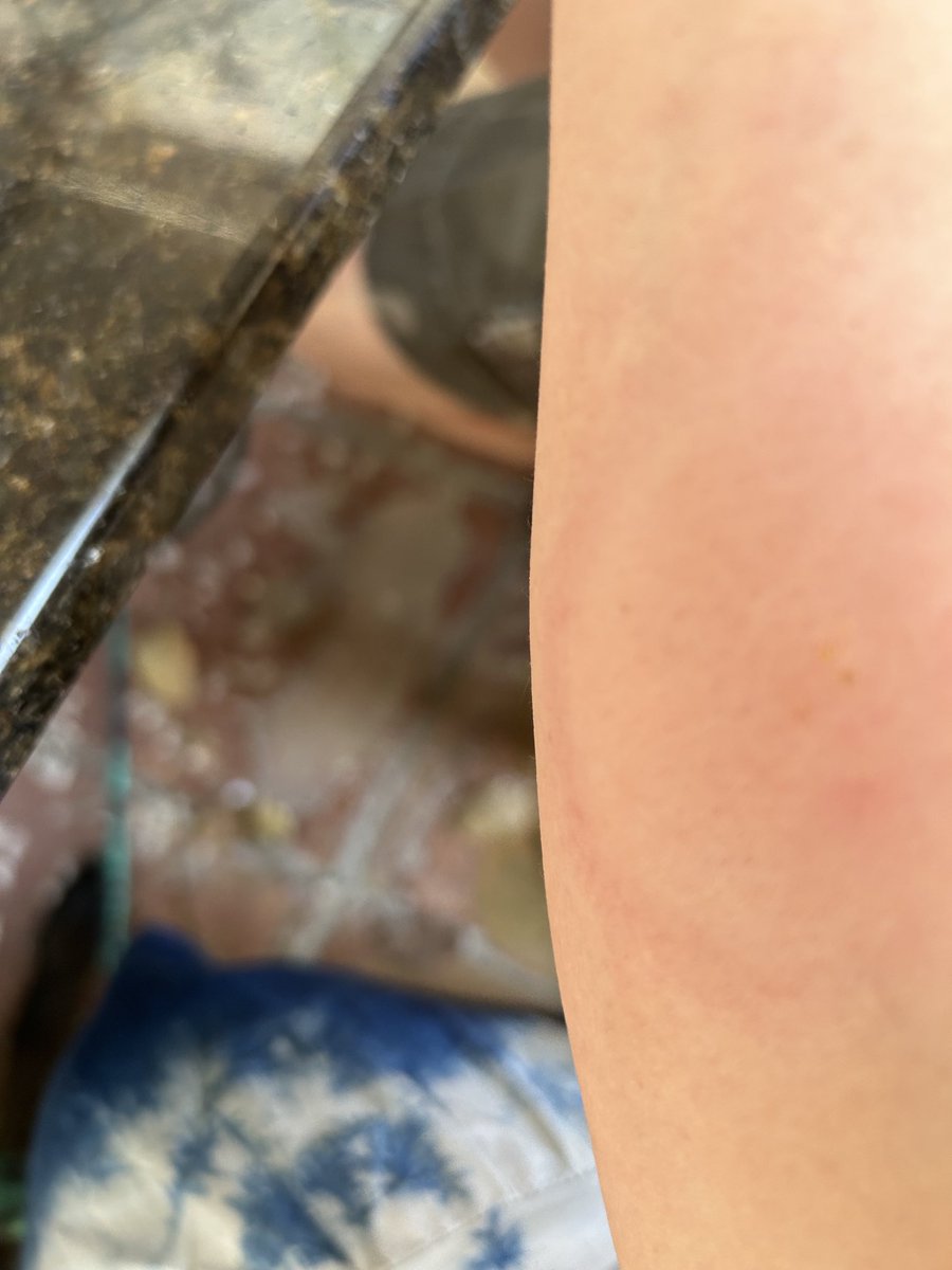 #aracnocosas, es hora de despedirme de mis seres queridos?