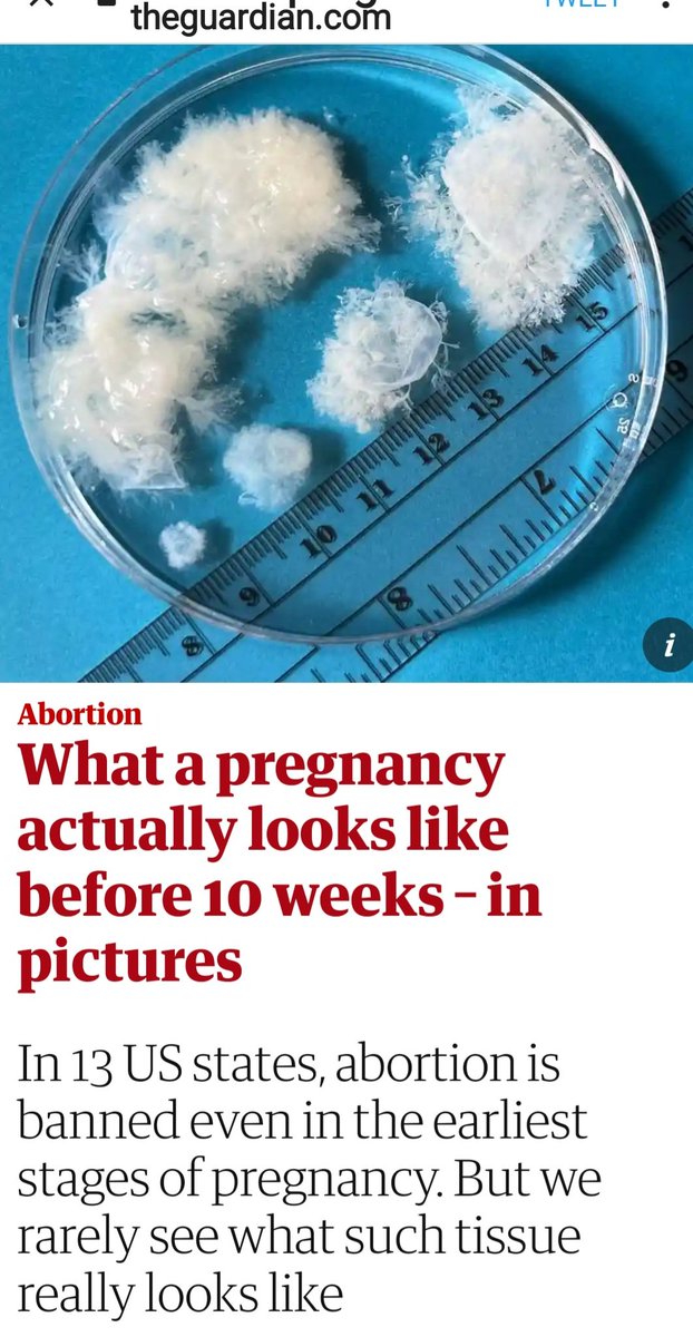 Charlie85915085's tweet photo. This is fetal tissue.
#StopFascistRepublicans from destroying women's lives.
#WomensRightsAreHumanRights
#WomensHealth
#NeverAgain
#StopChristofascism https://t.co/l1SN5KJzfK