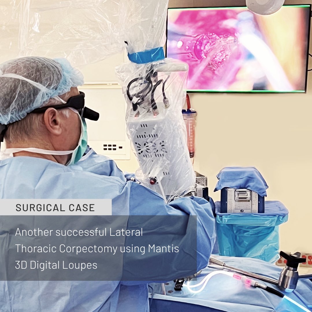 Mantis Health on Twitter "MantisHealth Lateral Corpectomy using