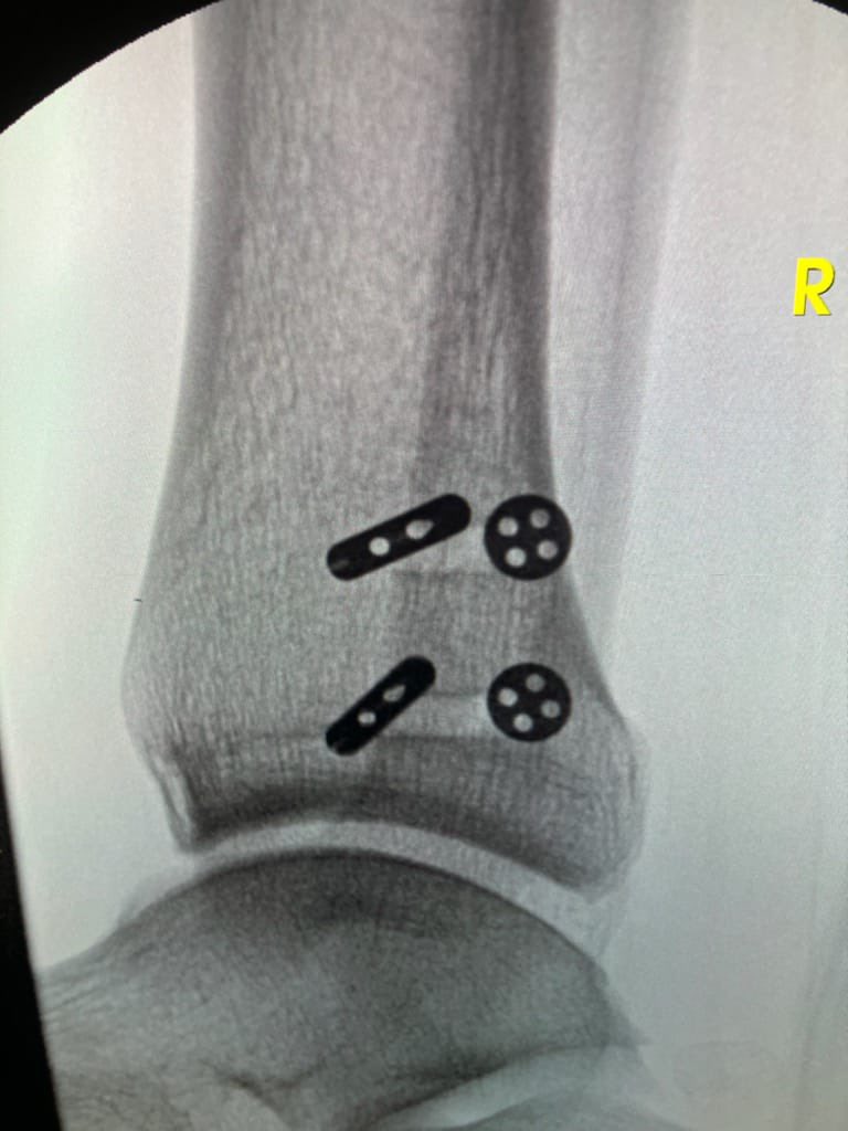 Phil Gould tweet media