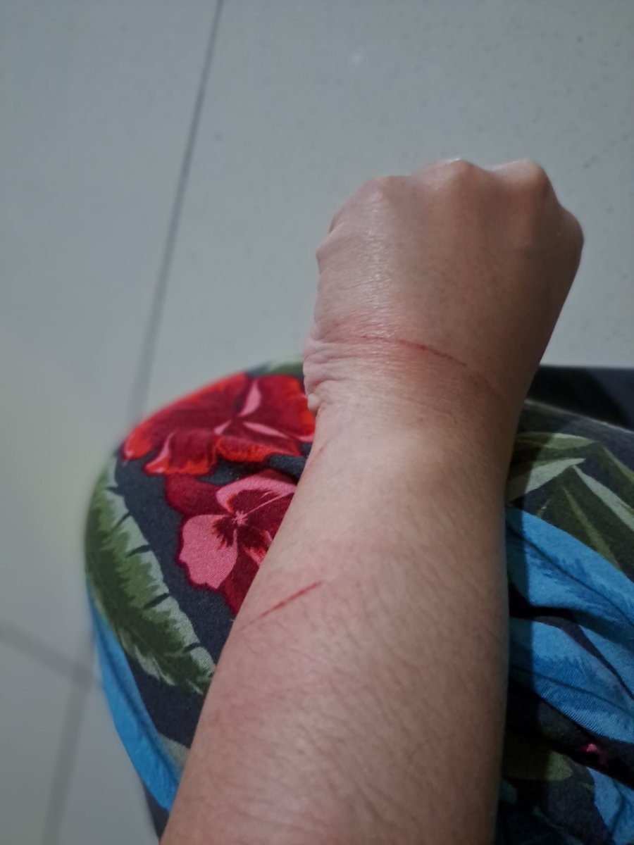 buttercxpie's tweet photo. @kochengfs Saya juga butuh pawlicing nih, di aniaya si oyen perkara saya mau bantu guntingin kukunya saja padahal... https://t.co/e5K2adVs4p