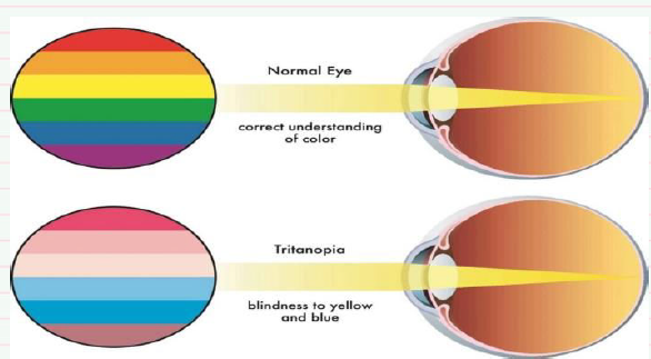 Tritanopia making people go from gay to trans  (this is a joke twitter, chill tf down) https://t.co/
