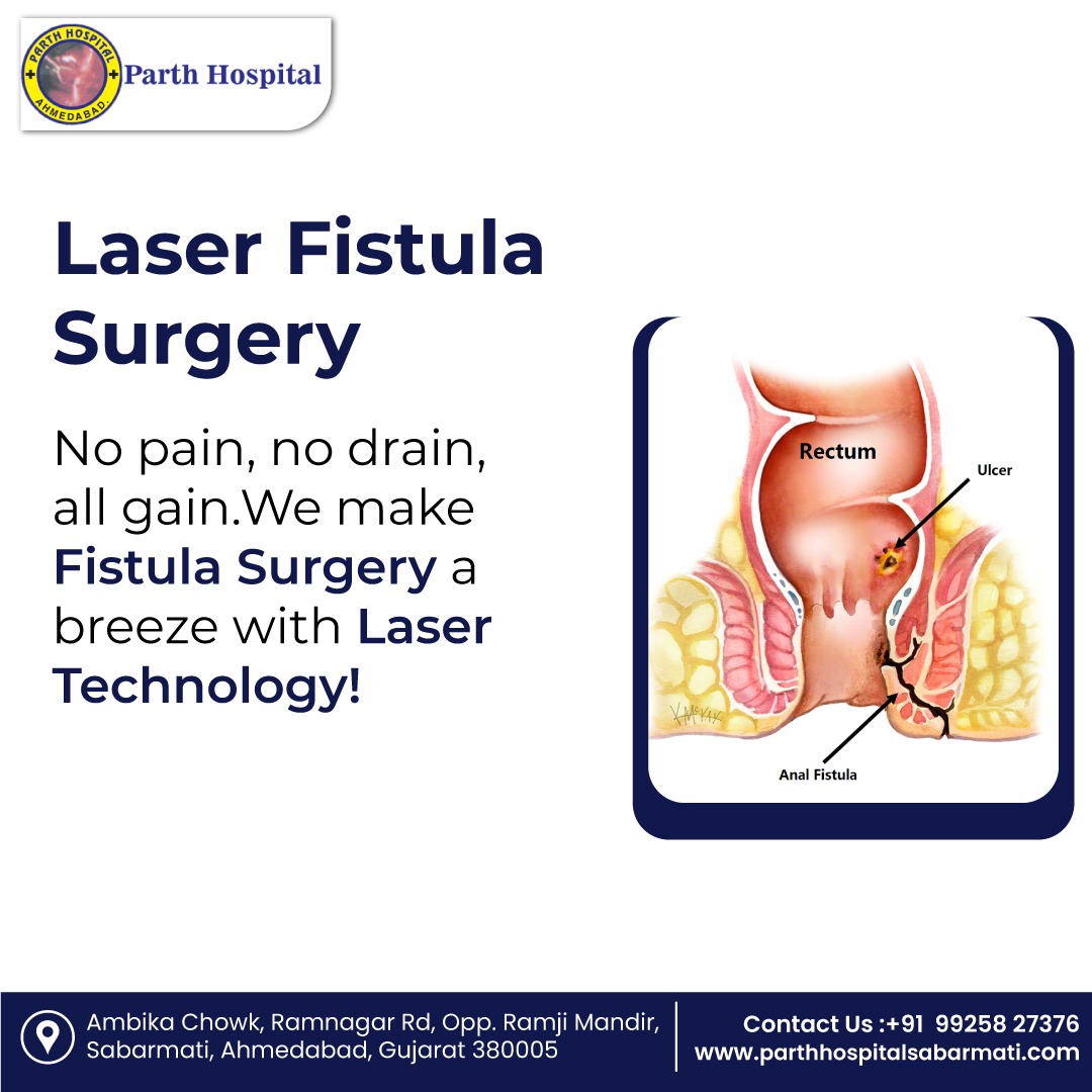 Laser Fistula Surgery No pain, no drain, all gain.

We make Fistula Surgery a breeze with Laser Technology!

#ParthHospital #lasersurgery #fistulasurgery #laserfistulasurgery #laser #lasertreatment #fistula #surgery #fissure #health #healthcare #piles #sabarmati #ahmedabad