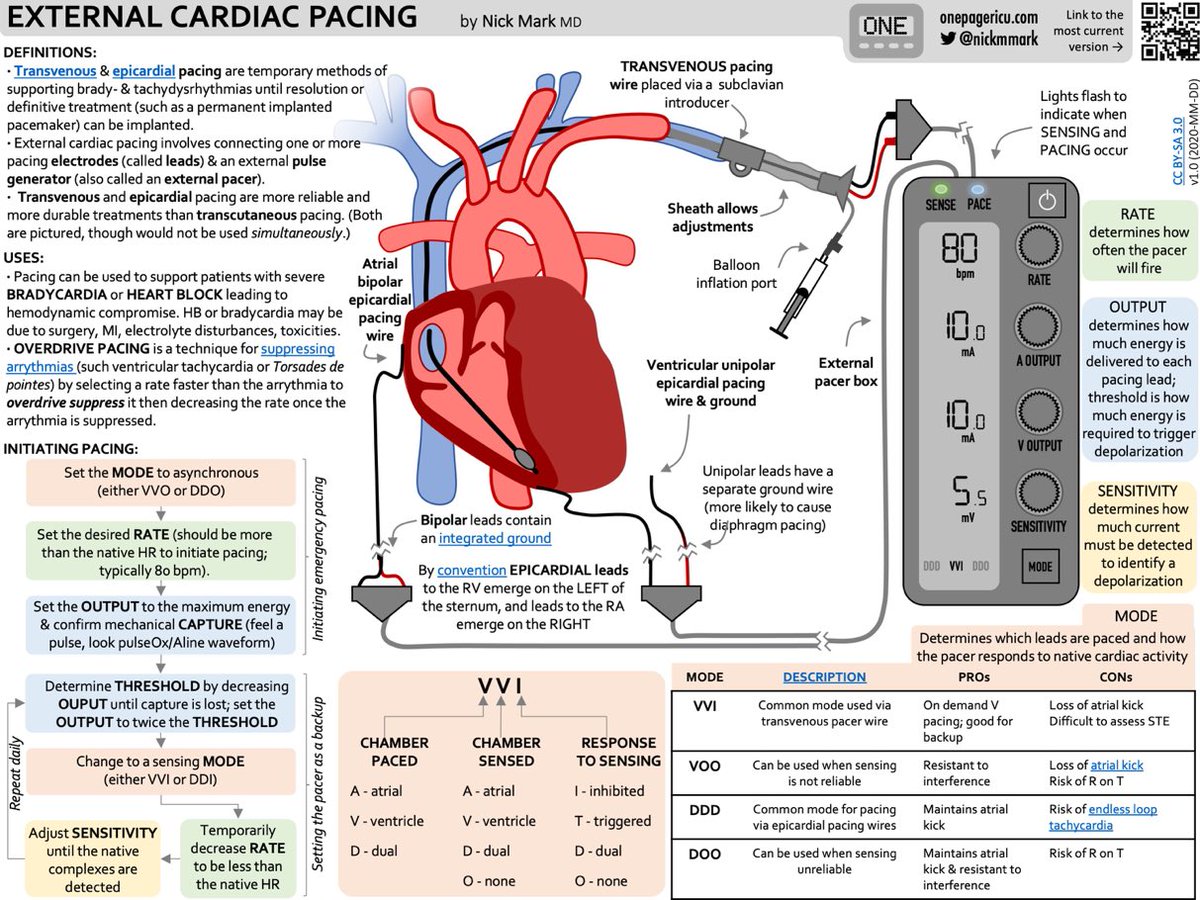 The ICU OnePager guide to transvenous and epicardial pacing in the ICU
 
@OnePagerICU 

#MedEd #MedTwitter #MedEd #medicine #CardioTwitter #Cardiology #CardioEd #cardiovascular