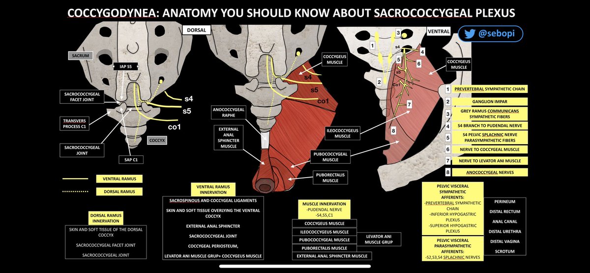 Sebopi's tweet photo. @mardominguezgar Muy buen hilo @mardominguezgar muy ilustrativo para afrontar el tratamiento de la #coccigodinia. Permiteme que te lo complemente con este esquema anatomico:
👇 https://t.co/CBrDdIlYXp