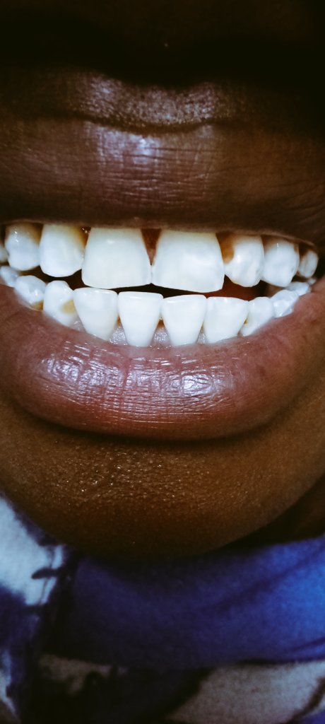 TeethJoel's tweet photo. https://t.co/VU5NbXF5Fh