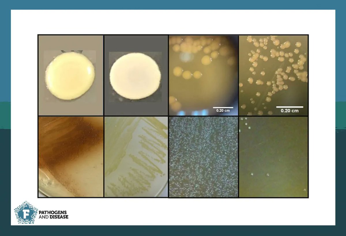 FEMSmicro's tweet photo. Prevalent in certain Latin American and European countries, B. contaminans infections in young children with #CF were tracked in this study. The authors correlated STs, phenotypic traits, &amp; co-colonizers with clinical outcome. Read the study in #PathogDis https://t.co/xgIsnken4a https://t.co/9PjjLrhiK6