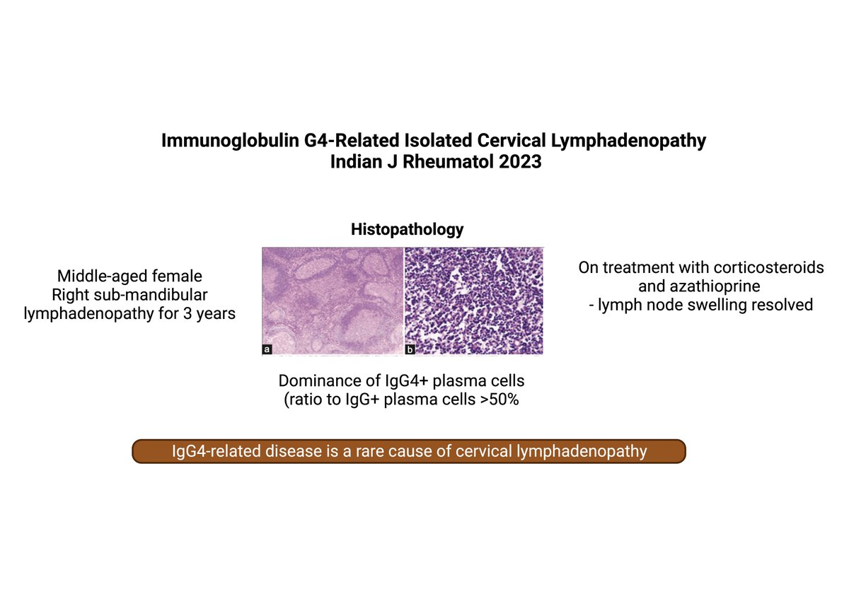 IJRheum's tweet photo. Cervical Lymphadenopathy- an uncommon presentation of #igg4rd Read more at https://t.co/vOEtZpCcqI https://t.co/0DJRyecnaz