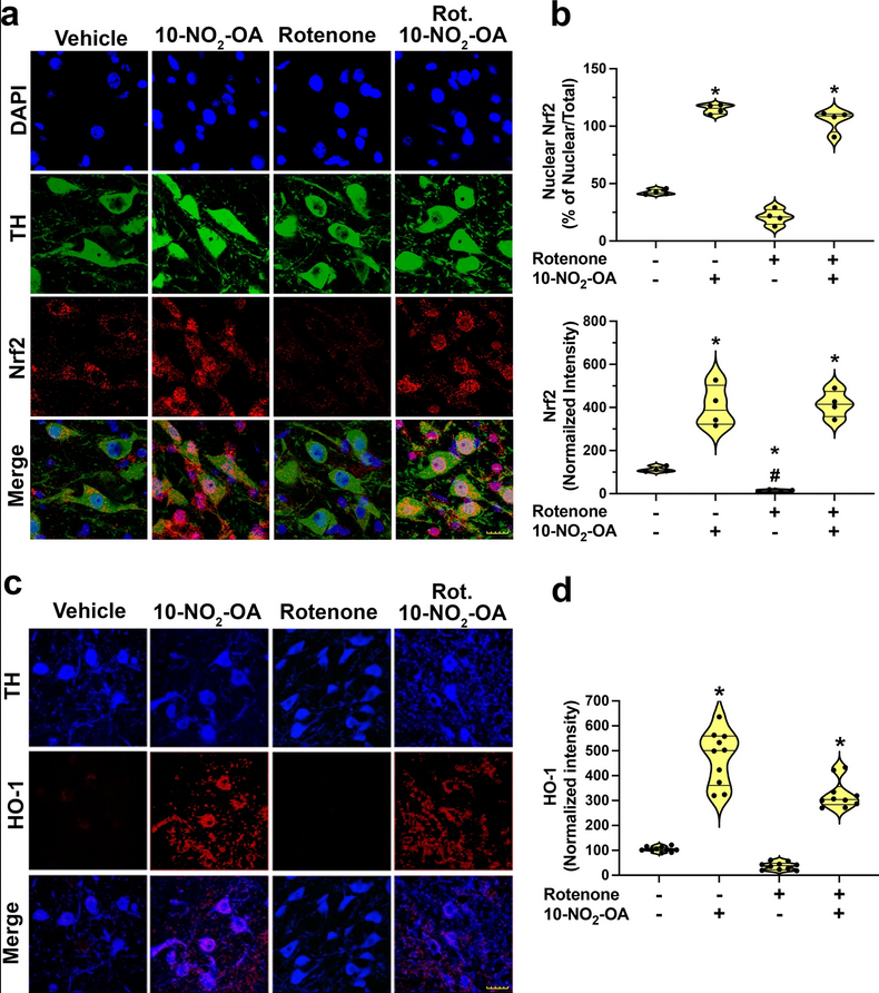 The Science of Parkinson's (@scienceofpd) on Twitter photo Interesting - <a href="/PittTweet/">University of Pittsburgh</a> researchers report on the in vitro & in vivo neuroprotective actions of a fatty acid nitroalkene in models of #Parkinsons; It activated Nrf2-regulated gene expression & inhibited NOX2 & LRRK2 hyperactivation
nature.com/articles/s4153… Interesting - <a href="/PittTweet/">University of Pittsburgh</a> researchers report on the in vitro & in vivo neuroprotective actions of a fatty acid nitroalkene in models of #Parkinsons; It activated Nrf2-regulated gene expression & inhibited NOX2 & LRRK2 hyperactivation
nature.com/articles/s4153…