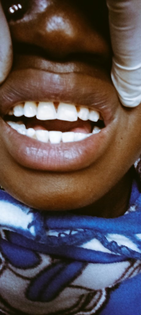 TeethJoel's tweet photo. https://t.co/DLeWvEQSk0