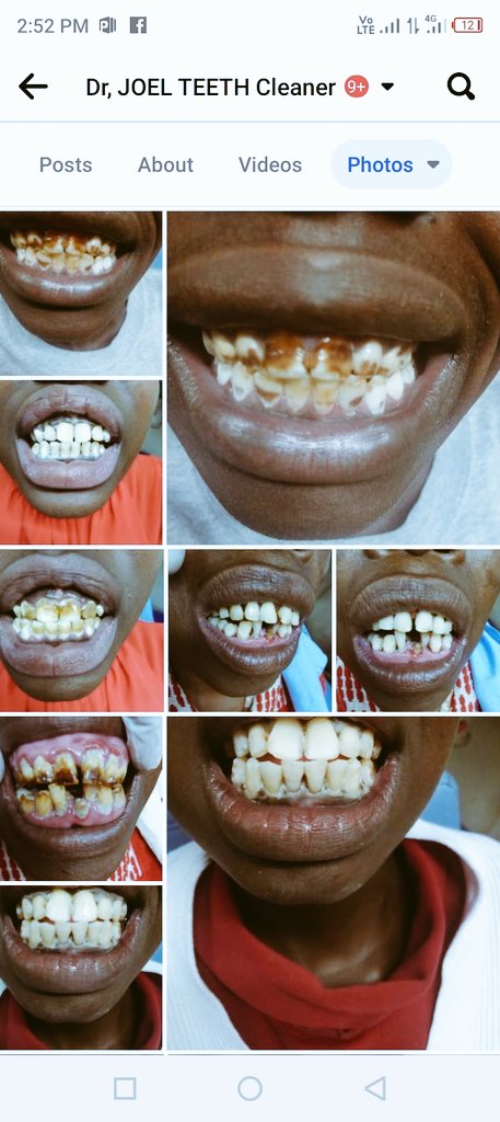 TeethJoel's tweet photo. https://t.co/DLeWvEQSk0