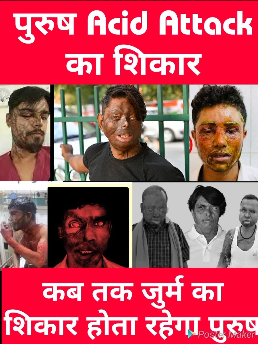 Till Today, I used to think that ACID ATTACKS happen only on Women, but this picture REVEALED THE REALITY.
*
Why such facts are hidden from the Society? Only &amp; Only women's problems are highlighted,why not MEN?
*
Is the man outside the society?
#GenderBiasedLaws #EqualityMatters