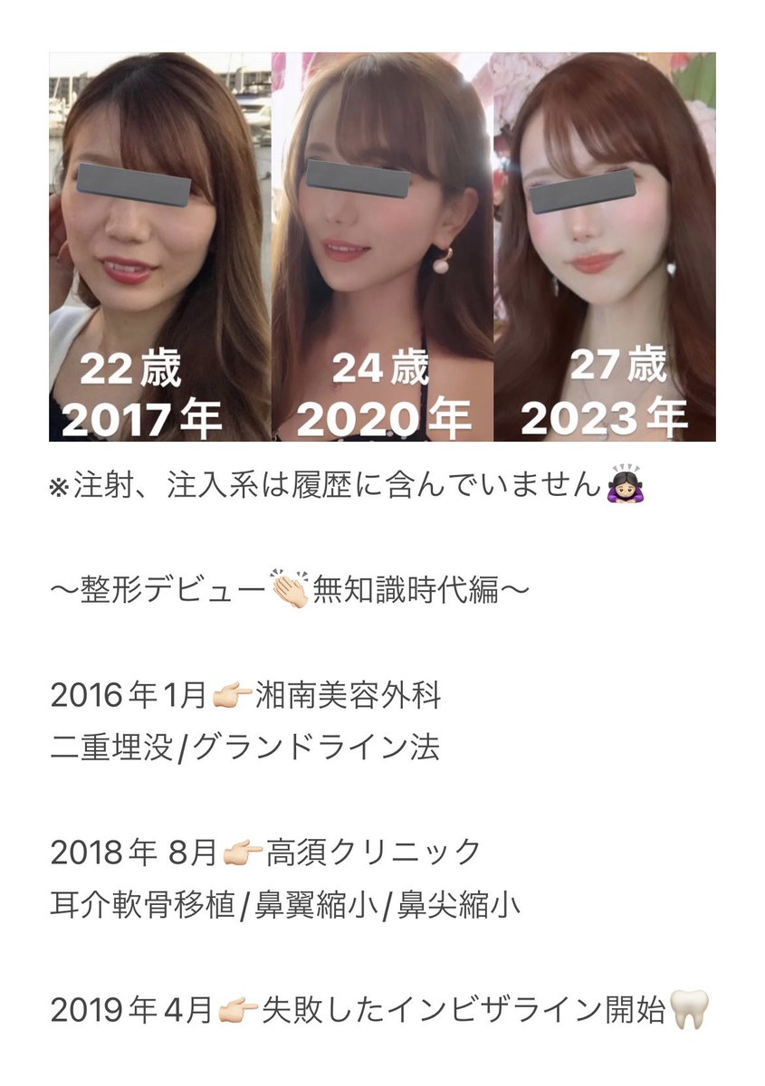 整形履歴書大公開😂 https://t.co/8lLudBvhGF