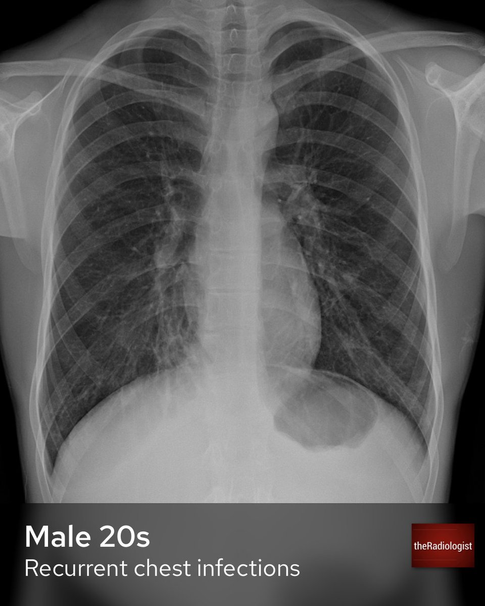 theRadiologist on Twitter "A male in his 20s presents with recurrent