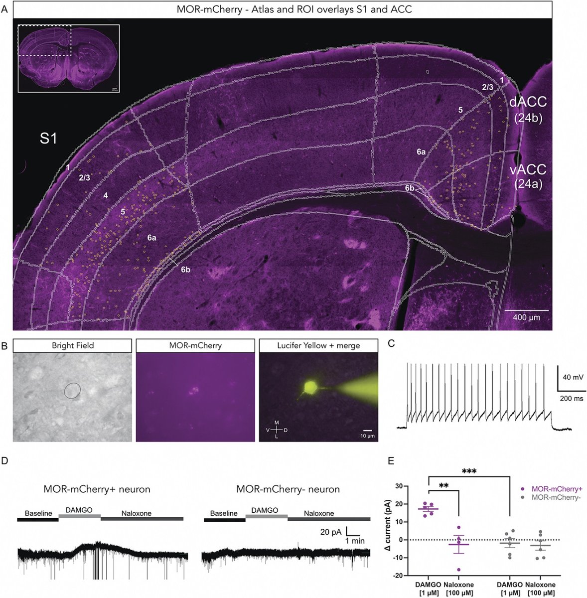 Sedolor's tweet photo. 📘Distinct and sex-specific expression of mu opioid receptors in anterior cingulate and somatosensory S1 cortical areas.
https://t.co/mfGu1rztYi
DOI: 10.1097/j.pain.0000000000002751 #receptores #dolor https://t.co/q1OqwINS5e