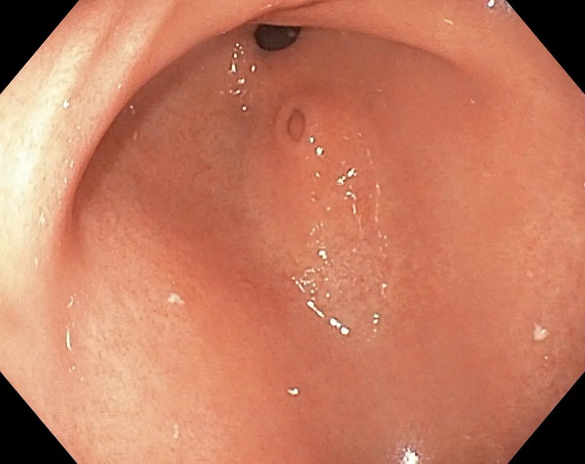 Keith Siau tweet media