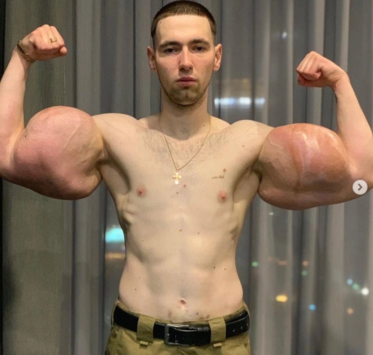 RevTerfy's tweet image. Should we affirm these guys? #synthol #SwoleIdentity #TransMuscular