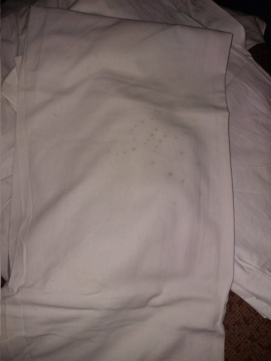 anilnil881's tweet image. Disappointed with the dirty and used bed sheets provided on Rajdhani Express 20503 at GHY station. As a passenger, I expect clean and hygienic bedding during my journey. @RailMinIndia, please take action to ensure this doesn't happen again! #IndianRailways #CleanBedding