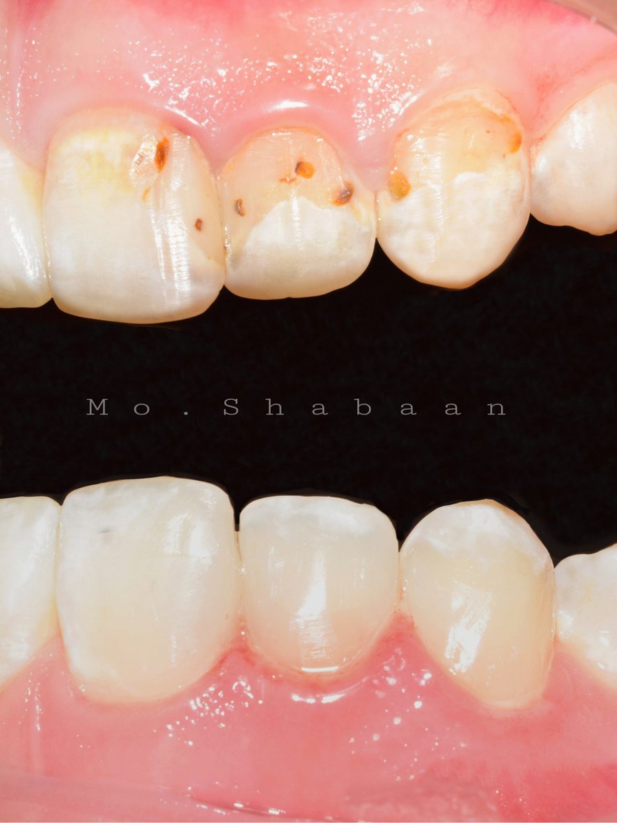 Msh3ban8's tweet photo. Feel the differenceمعايا 😌🔥 https://t.co/H27Pj9dQkG
