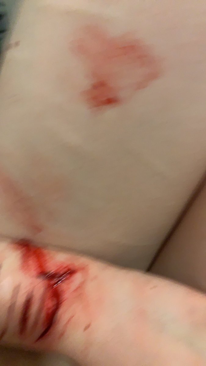 Js vibing. 
Does anyone else hate when the school sends you up to the hospital? 
TW: blood