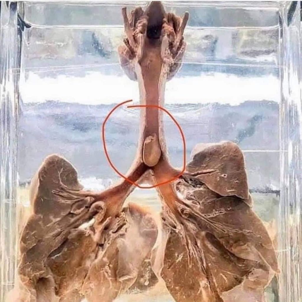 Los pediatras siempre recomiendan que los menores de 5 años no coman cacahuetes u otros frutos secos enteros y esta es la razón.

Se pueden asfixiar 😞