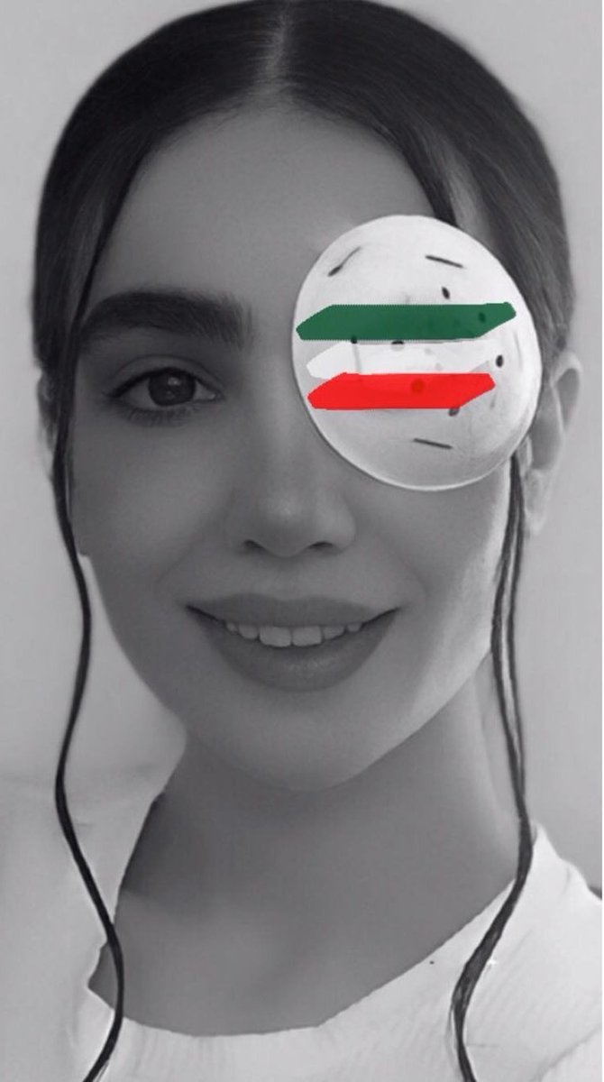 nti_mage's tweet photo. #کیمیا_زند از آسیب‌دیدگان چشم در اعتراضات:
«ما نشدیم درس عبرت دیگران
شدیم الگوی مقاومت و ادامه دادن»
اونایی که هزینه سنگین دادن از ادامه این راه میگن 
ما چرا باید جا بزنیم!؟؟
#زن_زندگی_آزادی 
#مهسا_‌‌‌‌‌‌‌‌‌‌‌‌‌‌‌‌‌‌‌‌‌امينی https://t.co/FXxMCm3VJW