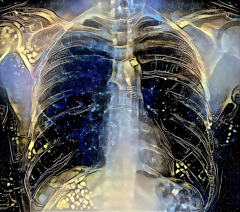 #NFTdrop // Introducing...

XR Chest Private Study #265
AI-enhanced chest X-ray
Unique 1/1 masterpiece
Inspired by celestial

opensea.io/assets/matic/0…

0.005 ETH, gas-free Polygon

Medical Art Club: MD + AI = ?
linktr.ee/mdartclub

#medicalart #radiologyart #xrayart