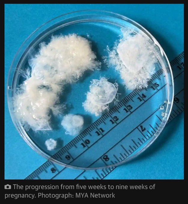 Is the &ldquo;escaping baby&rdquo; in the room with us right now? https://t.co/jEh4VF0PLL<a href="/tag/ad"class="tags"><span>#ad</span></a><a href="/tag/leesasleep"class="tags"><span>#leesasleep</span></a>