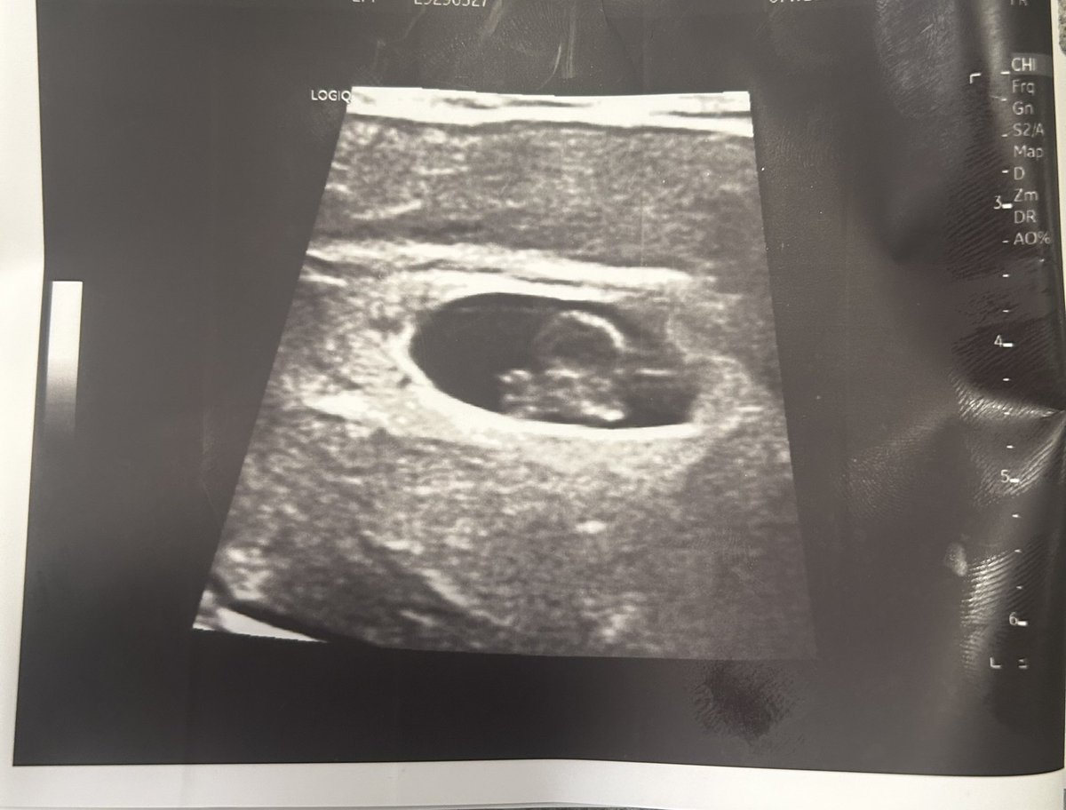 ShaneConnelly's tweet photo. A year my family and I could have never  imagined. loss...no light… no hope …In saying that, we have tried so hard to see a light, the positives..hope .We weren’t sure what our timeline would look like to grow our family again …but we looked for that light and we found it .. . https://t.co/5cY1avo5jA