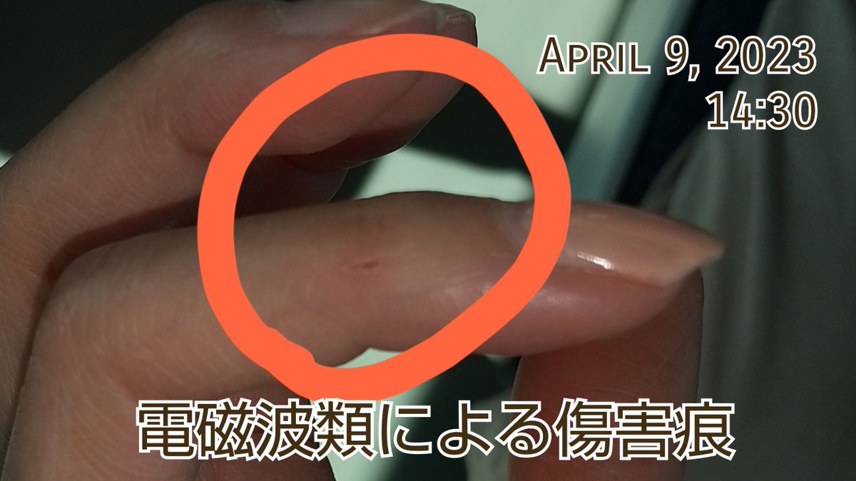 NozomiN9999's tweet image. 突然指、薬指に切り傷。私のケースでは恐らく奇行らが催する賭場で薬指の男が落選でもしたのだろう。オカルトは民の敵。民が特段のactionを奇行らにしていなくとも、当然の様に民をターゲット化し傷をつけてくる。

#集団ストーカー 
#ElectromagneticWave