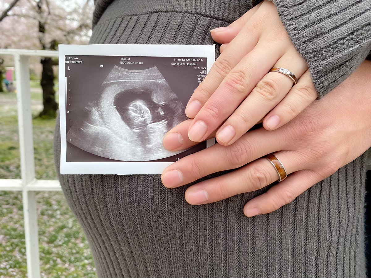Mkei_talkM's tweet photo. 結婚して妊娠して子供できてもうすぐ1歳って話しましたっけ？ https://t.co/04fqKjDj5Z