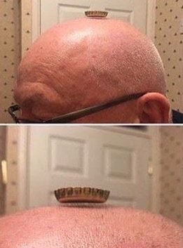 Me: Caesar is a bald bastard!

Legion: How dare you mock Caesars great hair!

Caesar's Hair: