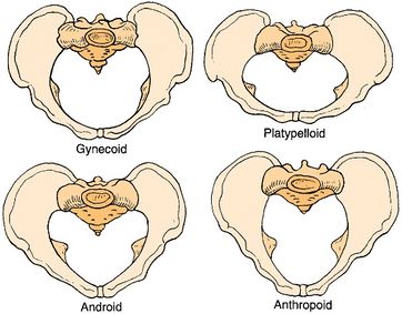 PutoMikel's tweet image. Los cuatro tipos de pelvis más comunes, todos se encuentran tanto en mujeres como en hombres