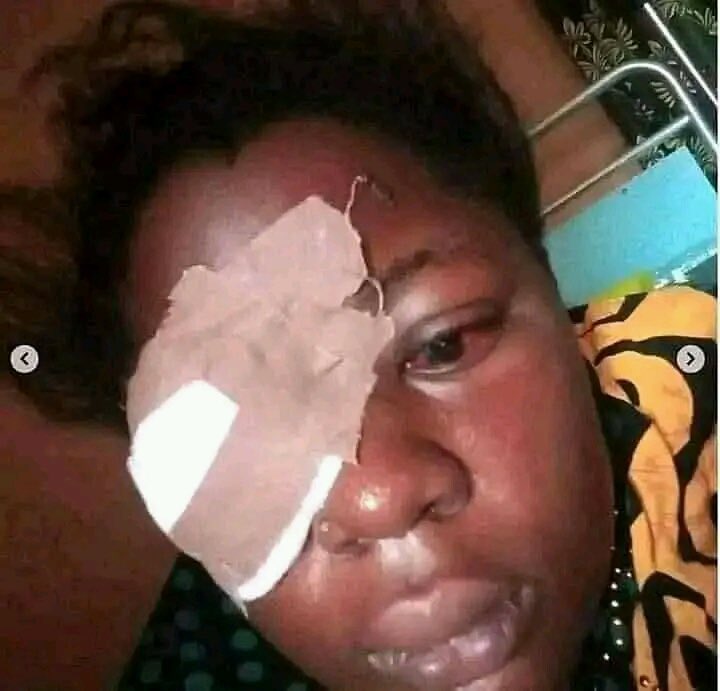 tshibusa's tweet photo. Pourriez-vous m’aider à traduire en justice mon beau-frère. Regardez ce qu’il a fait à ma cousine, simplement parce qu’elle a insulté sa maman. https://t.co/SXaN2DqDv1
