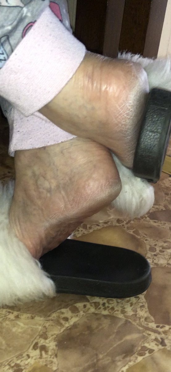 CfootBb's tweet photo. Happy Easter 🐰 mature footslut grandma busy in the kitchen #roughheel #toespread #justAddCum #thicksoles https://t.co/hGRFN76a6r