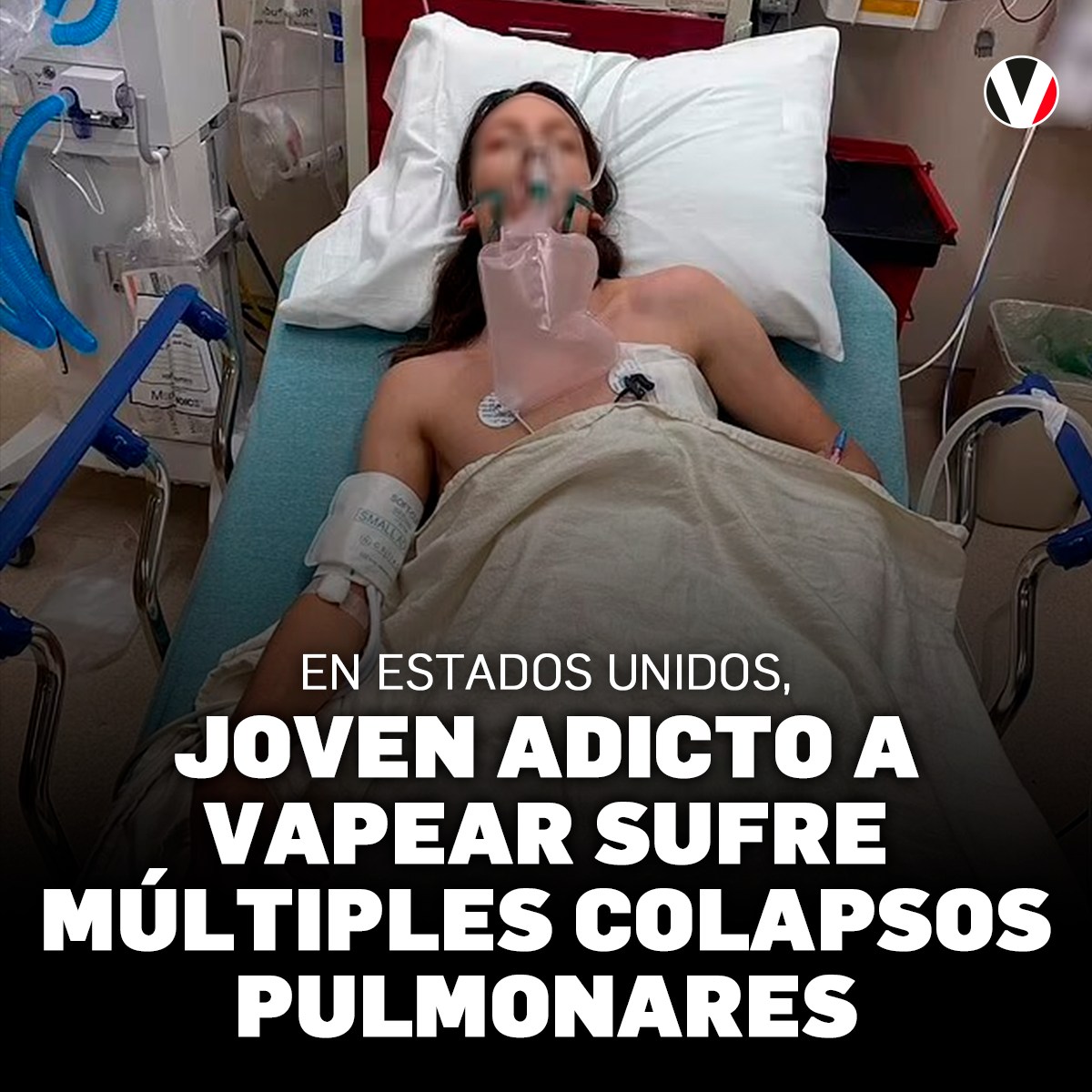 Draven Hatfield no ha cumplido aún 22 años y ya ha sufrido múltiples colapsos pulmonares debido a su uso desmedido de cigarrillos electrónicos. Doctores compararon sus pulmones con los de un hombre que ha sido adicto al cigarrillo por 30 años.
▶️ bit.ly/3ZPEhN4
