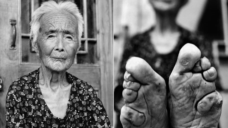 ISTANDBYOU's tweet photo. The #history of #footbinding https://t.co/wRiaYK2Em5 https://t.co/abOur0lRtR
