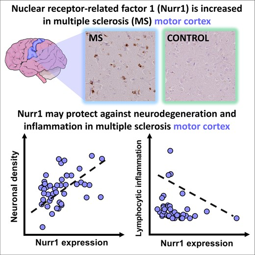 Dr Imran Sheikh 🩺 (@drimransheikh) on Twitter photo Pansieri et al. report that nuclear receptor-related factor-1 upregulation in the #MultipleSclerosis cortex associates with neuronal density and lymphocytic inflammation.
<a href="/group_deluca/">De Luca's Group</a>
<a href="/JPansieri/">A Brainologist scientist</a>
bit.ly/3KCC2bT Pansieri et al. report that nuclear receptor-related factor-1 upregulation in the #MultipleSclerosis cortex associates with neuronal density and lymphocytic inflammation.
<a href="/group_deluca/">De Luca's Group</a>
<a href="/JPansieri/">A Brainologist scientist</a>
bit.ly/3KCC2bT