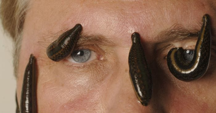 OCT_MattAdams's tweet photo. Leech Brands 🪱

We interact with them daily, often unaware. 

They're more common than you think, and it's time to uncover the truth.

Here's what you need to know. https://t.co/0YE6E0oxk5