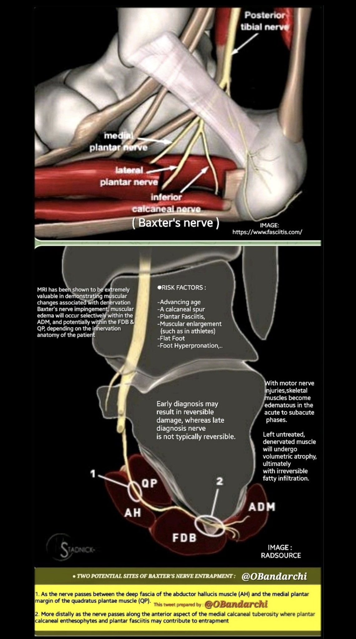 Common Causes of Heel Spurs and What to Do About Them - Mountainview Foot  and Ankle