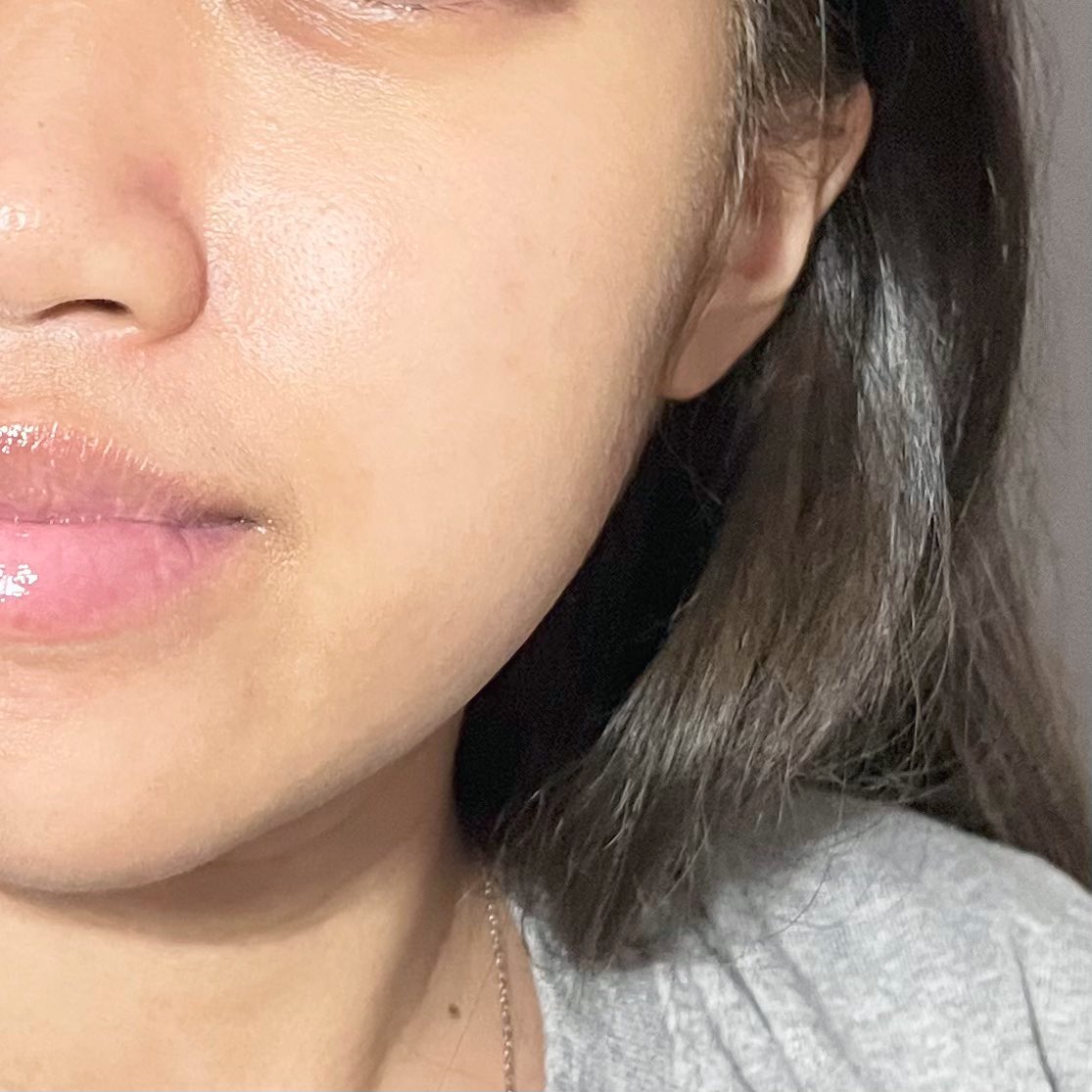 แกกกนี่ใช้พอนด์ส เซรั่มกลูต้าแล้วรักผิวงะ ผิวโนฟิลเตอร์ใดๆ แต่ดูความใสดิ ใสสุดๆ จุดดำ รอยสิว ฝ้าแดดแทบไม่มีเลออ เพราะตัวนี้มีกลูต้า-บูสซี นางลดรอยดำเริ่ดกว่าวิตามินซี 40 เท่าเลย ผิวหมองคล้ำ มีรอยสิวต้องจัด จุดดำจางลงไวจิงง หน้าสดใสสุดๆ #ใช้จริงรีวิวจริง #หน้าสดใส