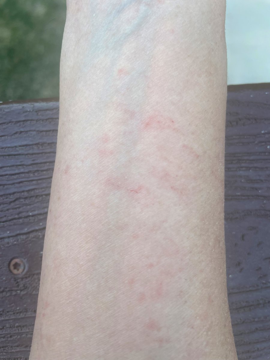 Allison_in_CO's tweet photo. #Ruggable wounds because the pads are like scouring pads https://t.co/thYvOiwaJk