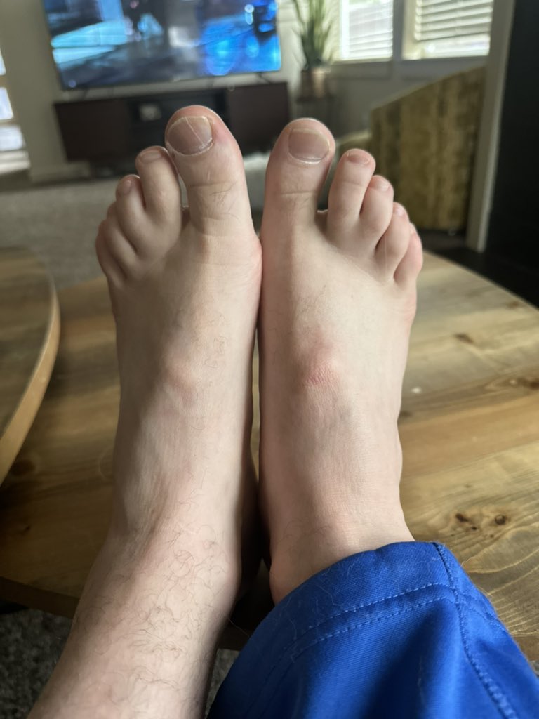 Whoneedssocks's tweet photo. Golf and toes! #feetfinder #toes #feet #feetlover #feetfethish https://t.co/DXNj55zOY2