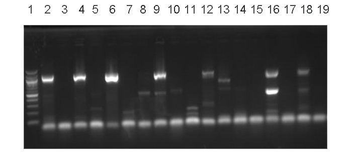 OAE_ohir's tweet photo. #RFLP #MI
👉A more affordable method than sequencing to characterize Bulinus snails from schistosomiasis endemic regions.
🐌Characterization of freshwater snail intermediate hosts of #schistosomes in four communities from Osun State, Southwest Nigeria
🔗https://t.co/7VEMbSGcE9 https://t.co/w3FVRpxoa2
