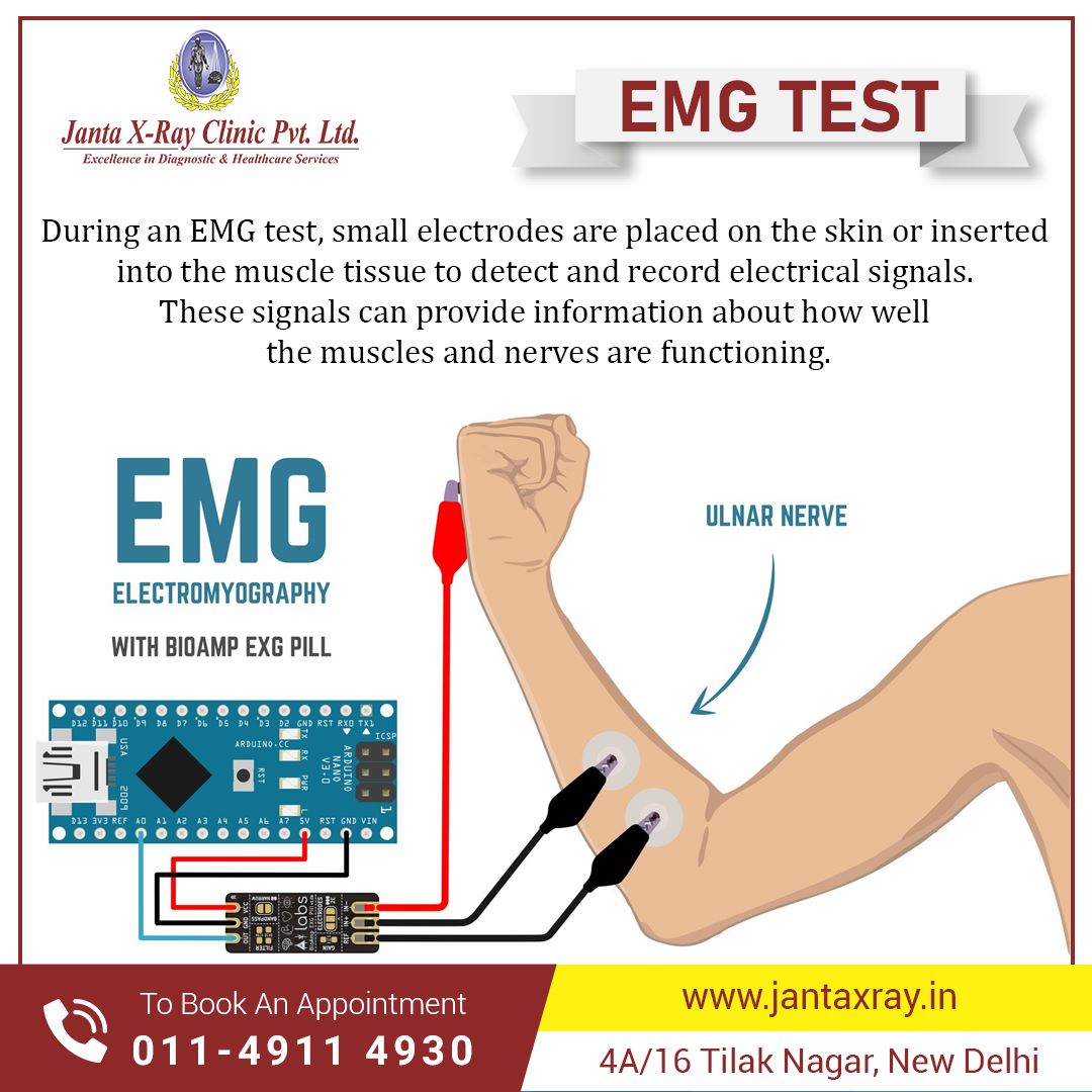 JantaXRayClinic's tweet image. #JantaXRay&apos;s #EMGtest is a breeze thanks to our skilled technicians and top-of-the-line equipment. Book your appointment today!
Contact us right away at 01149114930 or schedule your test online at jantaxray.in.
#EMGTest #EMGtesting #DiagnosticCentre #Pathlab #Radiology