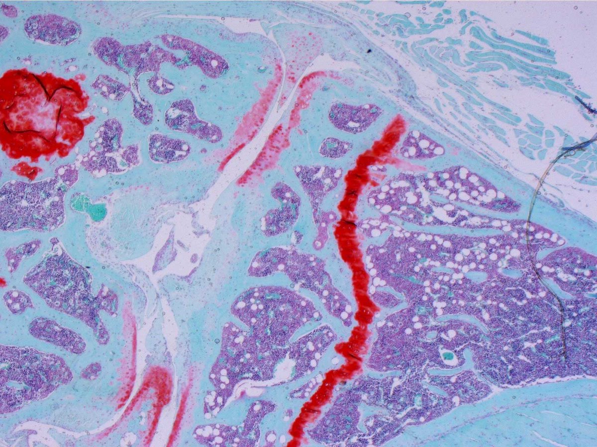 An amino acid that senses cellular stress offers an enticing target for new therapies aimed at suppressing inflammation or accelerating the healing of skin wounds, according to a new <a href="/ScienceTM/">Science Translational Medicine</a> study involving research in large animals and mouse models. scim.ag/2bw