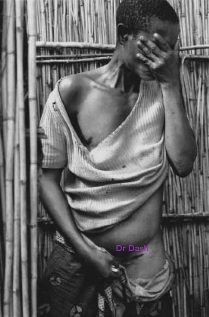 dr_dash250's tweet photo. Rape During Genocide Against Tutsi.

It is believed that anywere from 250,000 to 500,000 Tutsi females were, abused,raped, or sexually assulted.

All Tutsi Females Who survived the Genocide were direct victims of Rape, or Other Sexual Violence, or Were Profoundly Affected by it.

(Read thread)