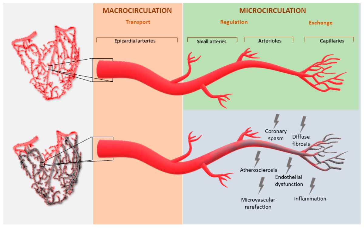 JCM MDPI (@jcm_mdpi) on Twitter photo #mdpijcm
📷Never miss this HIGHLY CITED article📷 #Review: Coronary Microvascular Dysfunction: PET, CMR and CT Assessment <a href="/ElisabettaBex/">Elisabetta Tonet</a>
Please visit here📷mdpi.com/2077-0383/10/9
#Angina #Microvascular_Dysfunction #Cardiac_Magnetic_Resonance #Cardiac_Computer_Tomography #mdpijcm
📷Never miss this HIGHLY CITED article📷 #Review: Coronary Microvascular Dysfunction: PET, CMR and CT Assessment <a href="/ElisabettaBex/">Elisabetta Tonet</a>
Please visit here📷mdpi.com/2077-0383/10/9
#Angina #Microvascular_Dysfunction #Cardiac_Magnetic_Resonance #Cardiac_Computer_Tomography