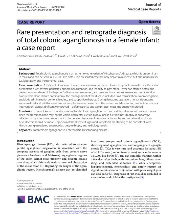 Read my latest #article on a #rare case of #hirschsprungs disease, published with <a href="/SpringerNature/">Springer Nature</a> in Journal of Medical Case Reports!