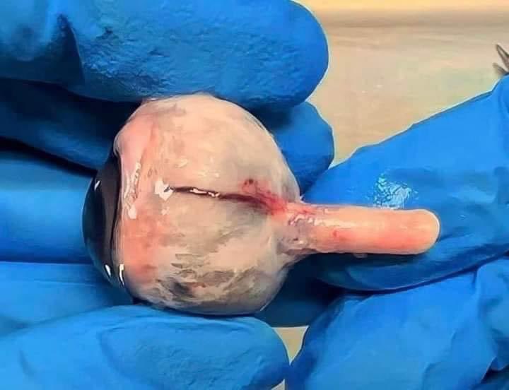 Así luce un ojo extraído de la órbita ocular del cráneo💀